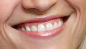 Patient smiling