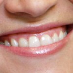 Patient smiling 