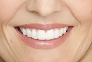 Patient smiling